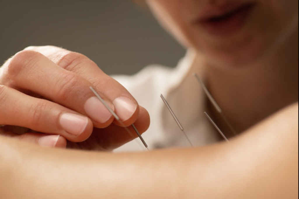 Benefits of Acupuncture and Chiropractic Treatment